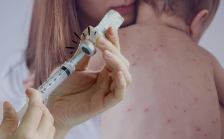 Salud y Educación alistan protocolo contra el sarampión